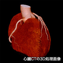 心臓CT02